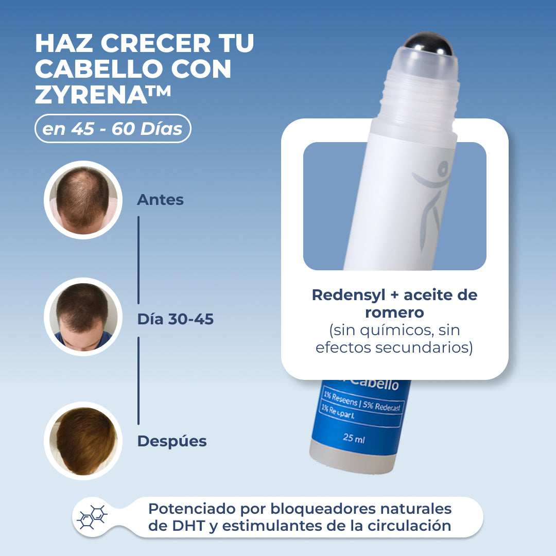 ZYRENA | Terapia capilar intensiva de uso diario